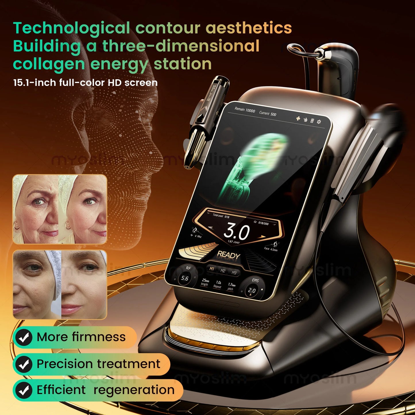 Professional 25D Max 360° Circle Line HIFU Machine | Salon-Grade Face Body Lifting Anti-Wrinkle Focused Ultrasound Device